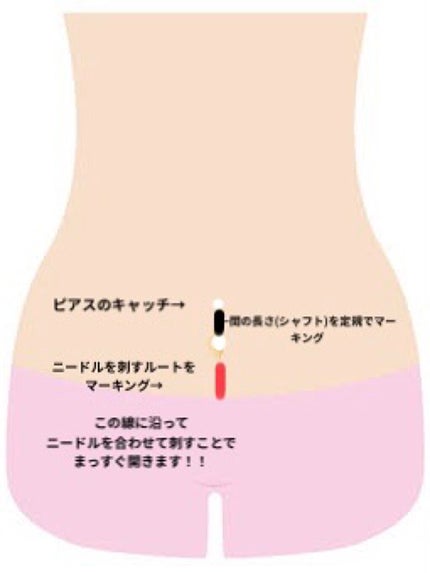 オロナインH軟膏 (医薬品)/オロナイン/その他を使ったクチコミ(3枚目)