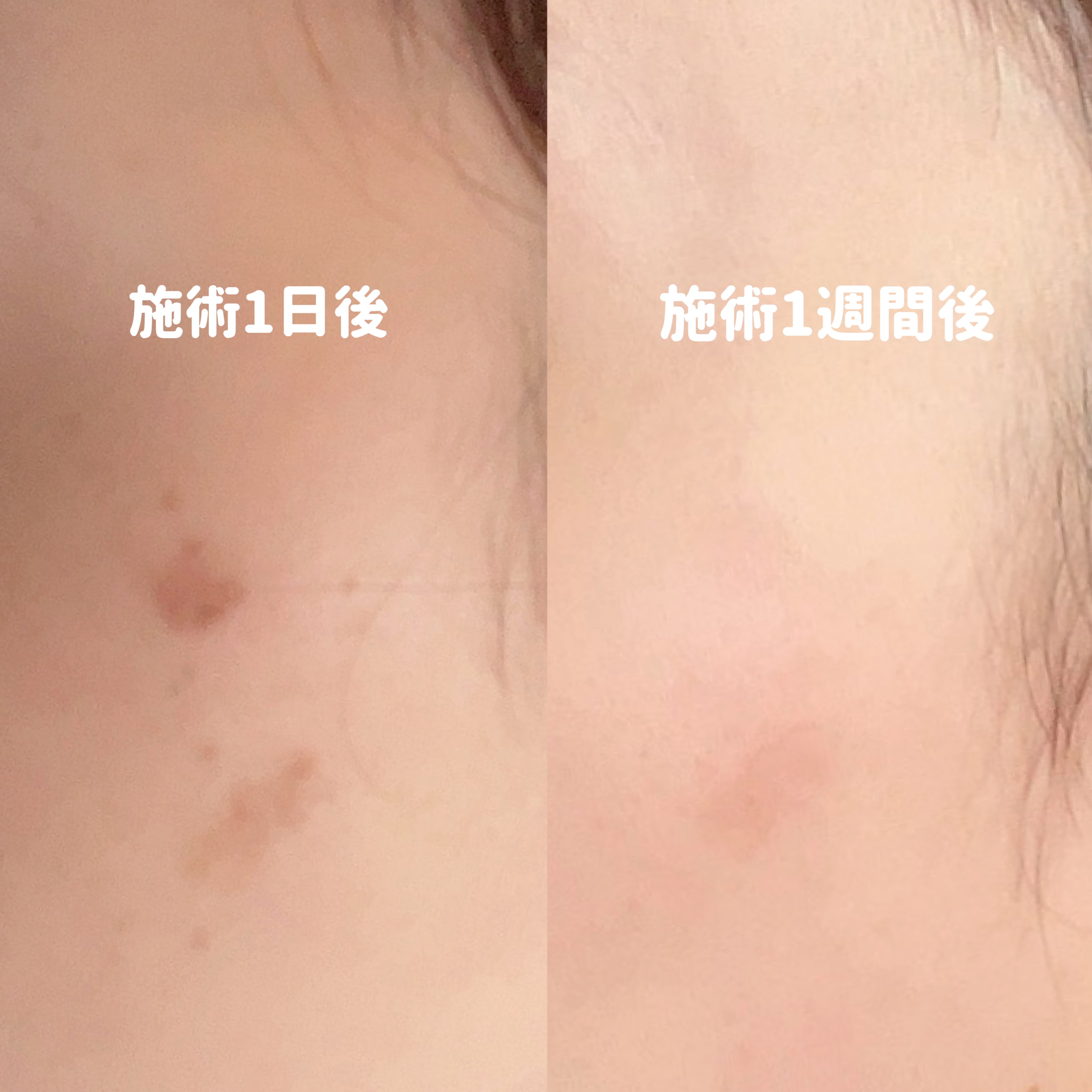 ニベアUV ディープ プロテクト＆ケア エッセンス/ニベア/日焼け止めローションを使ったクチコミ（2枚目）