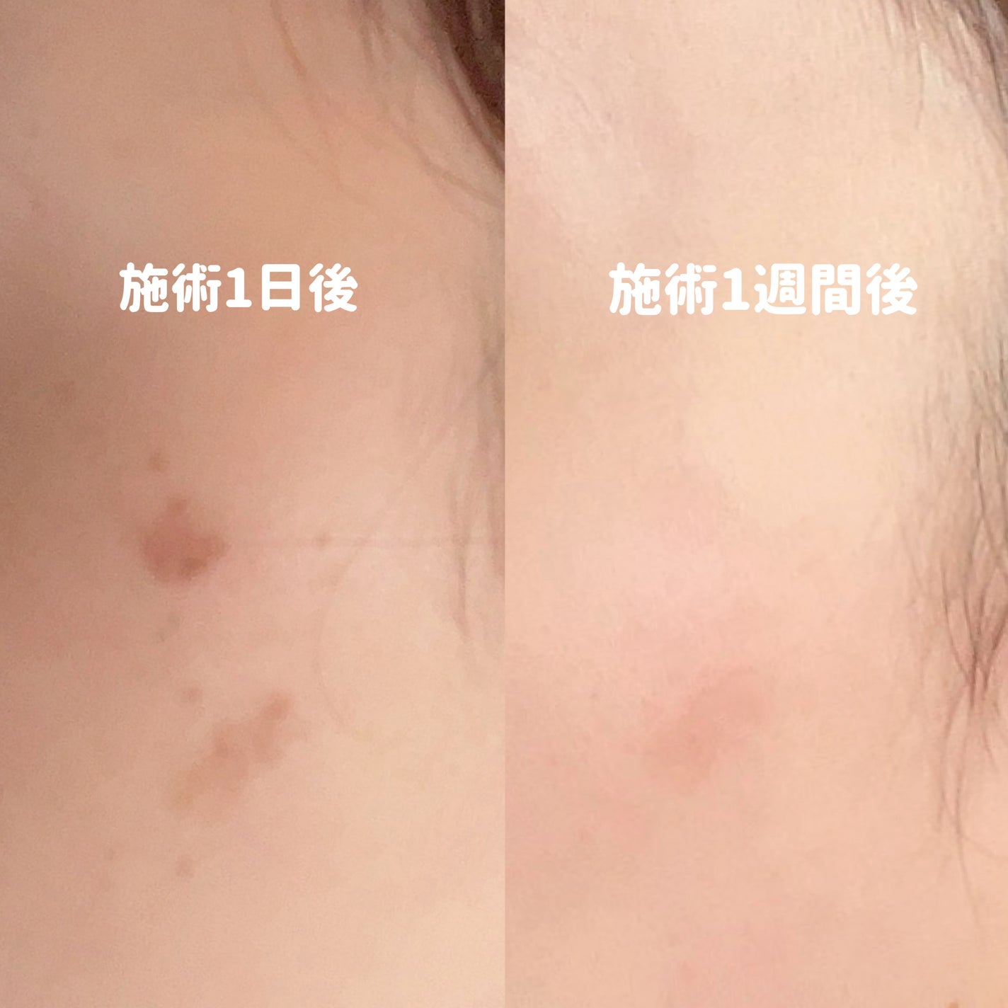 ニベアUV ディープ プロテクト&ケア エッセンス/ニベア/日焼け止めローションを使ったクチコミ(2枚目)