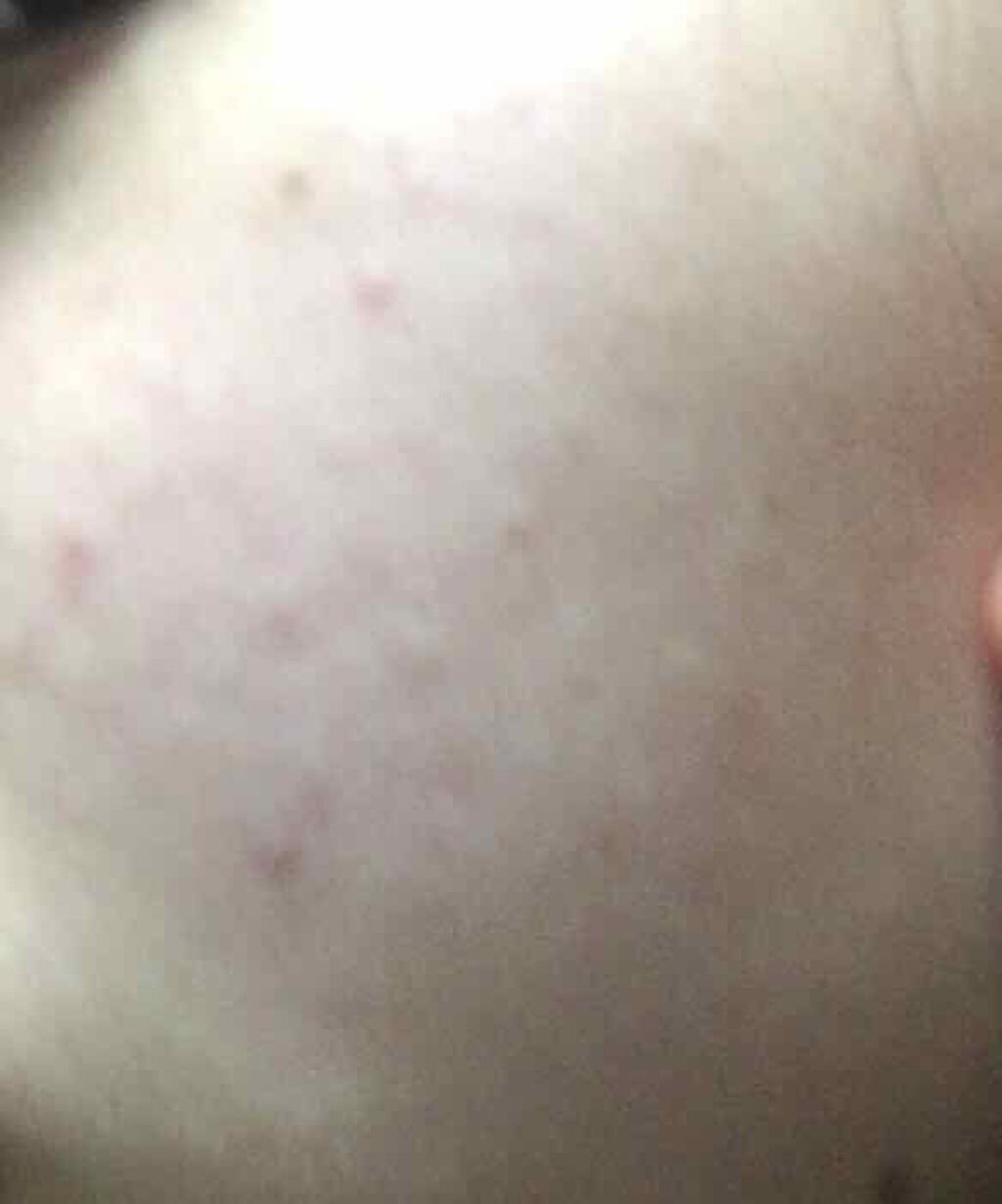 ロゼット 洗顔パスタ ガスールブライト/ロゼット/洗顔フォームを使ったクチコミ（2枚目）