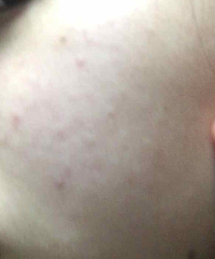 クリアターン 美肌職人 はとむぎマスク/クリアターン/シートマスク・パックを使ったクチコミ(2枚目)