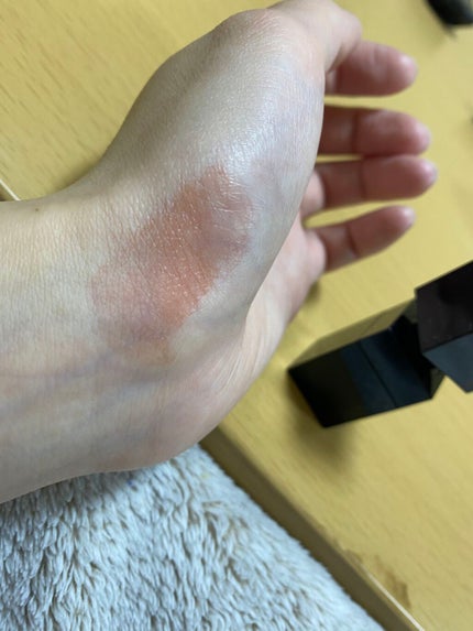 チーク ティント <ウォータリーチーク>/ADDICTION/リキッドチークを使ったクチコミ(3枚目)