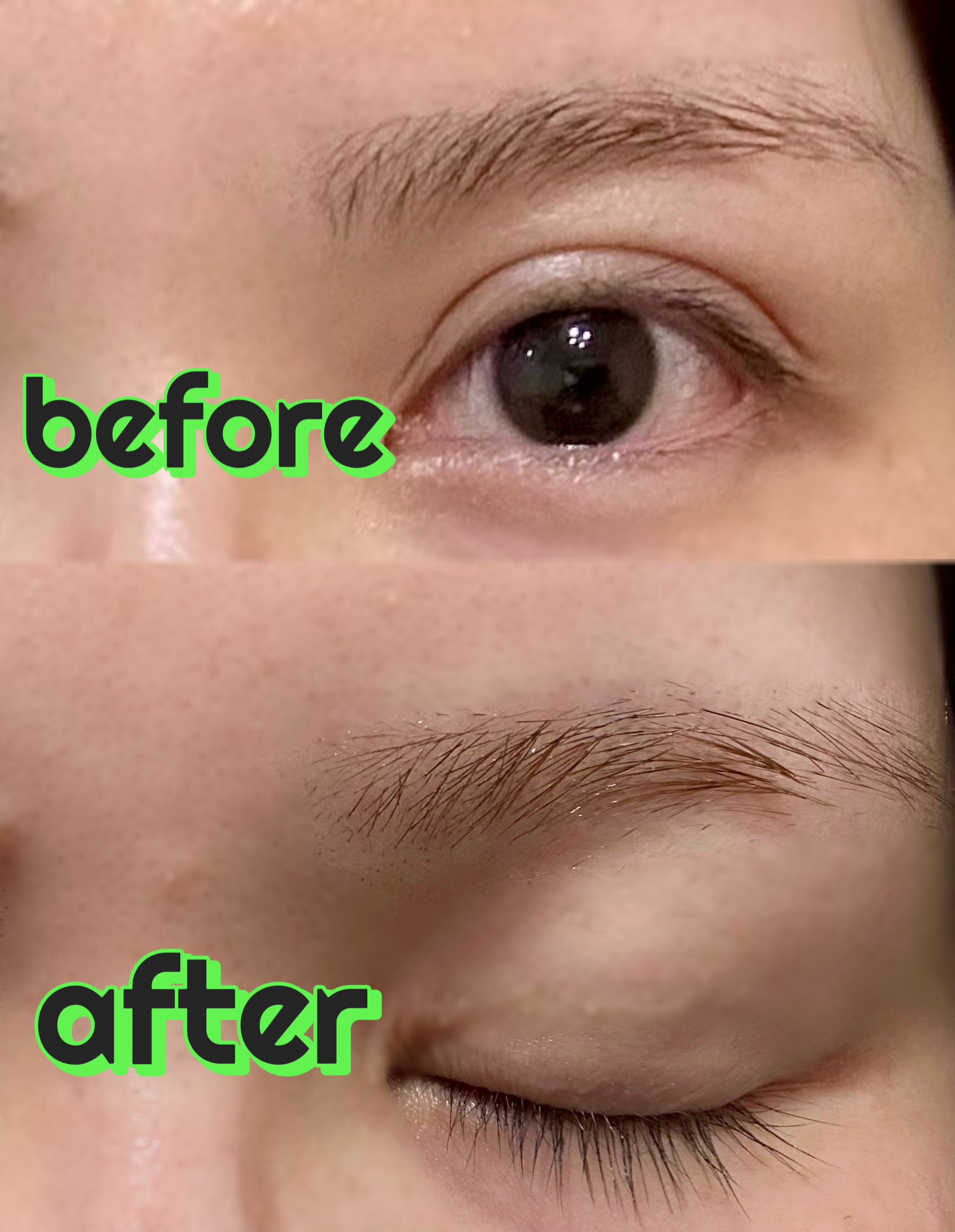 脱色クリーム スピーディー/エピラット/ムダ毛ケアを使ったクチコミ（3枚目）