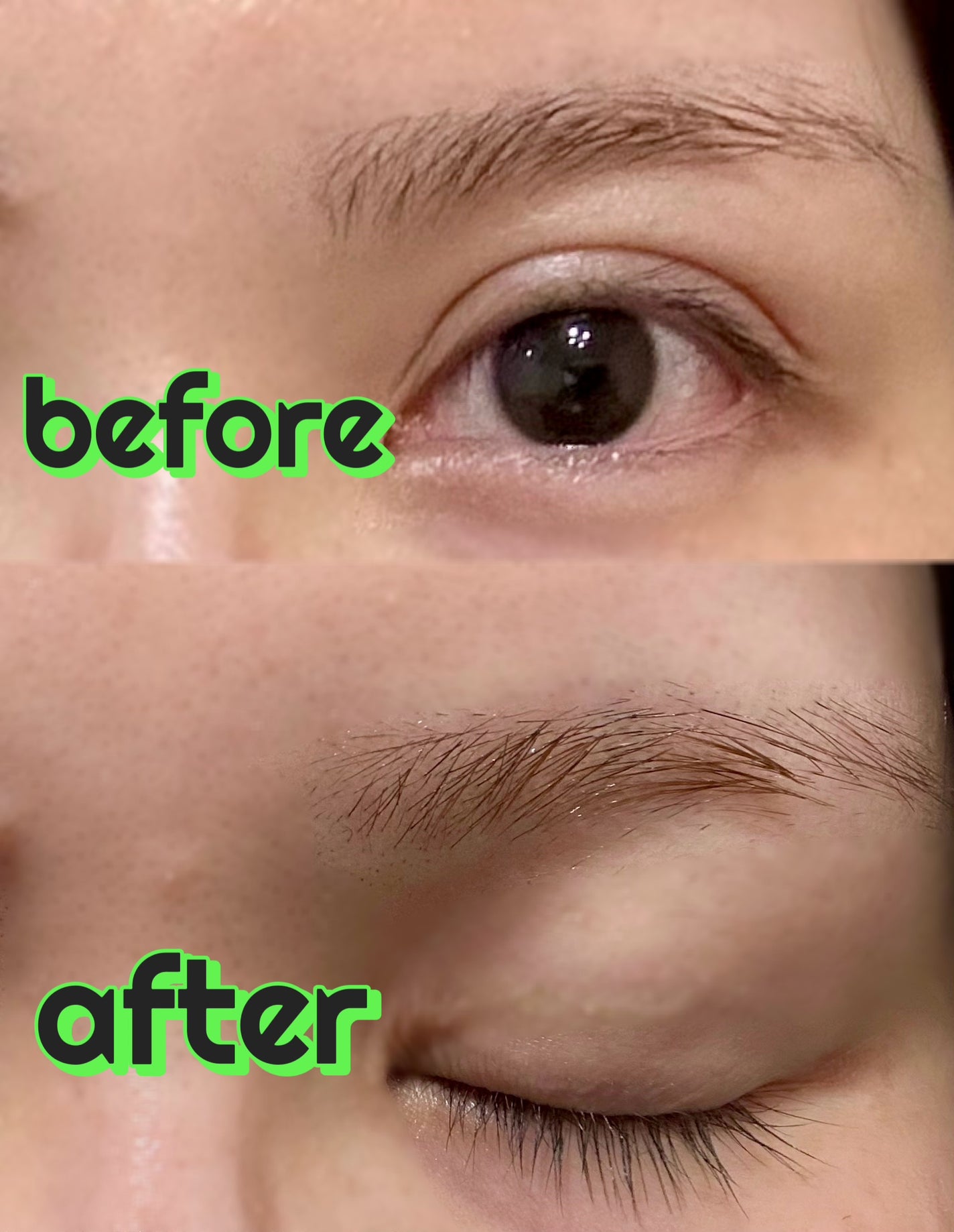 脱色クリーム スピーディー/エピラット/ムダ毛ケアを使ったクチコミ(3枚目)