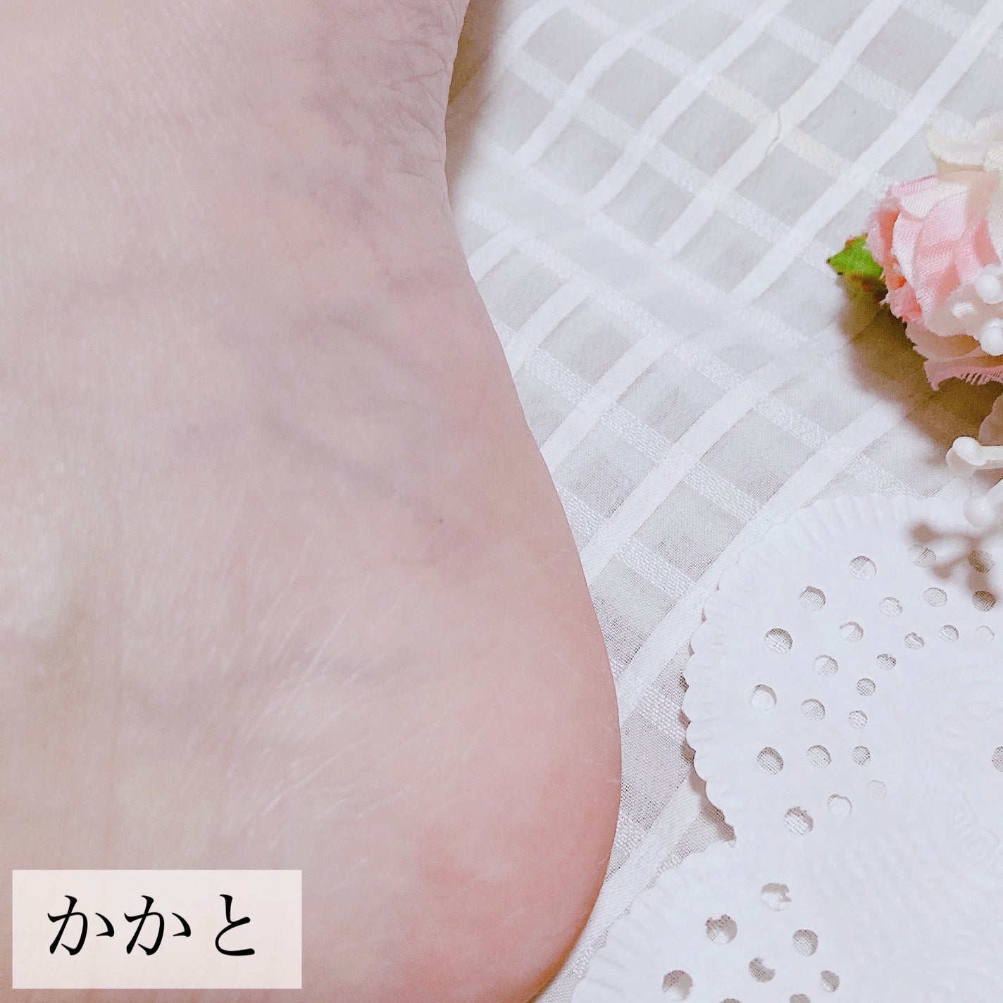 ゴウンバル クリーム/3WB/レッグ・フットケアを使ったクチコミ(5枚目)