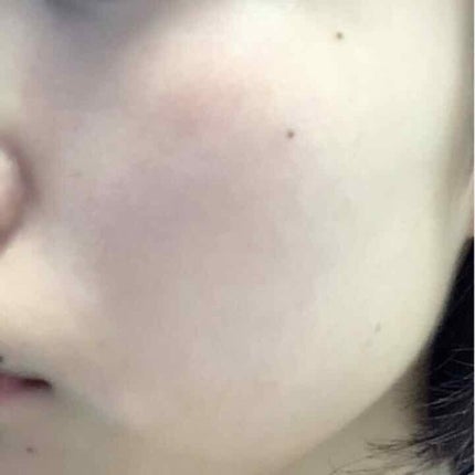 マシュマロホイップ 薬用アクネケア/ビオレ/泡洗顔を使ったクチコミ(2枚目)