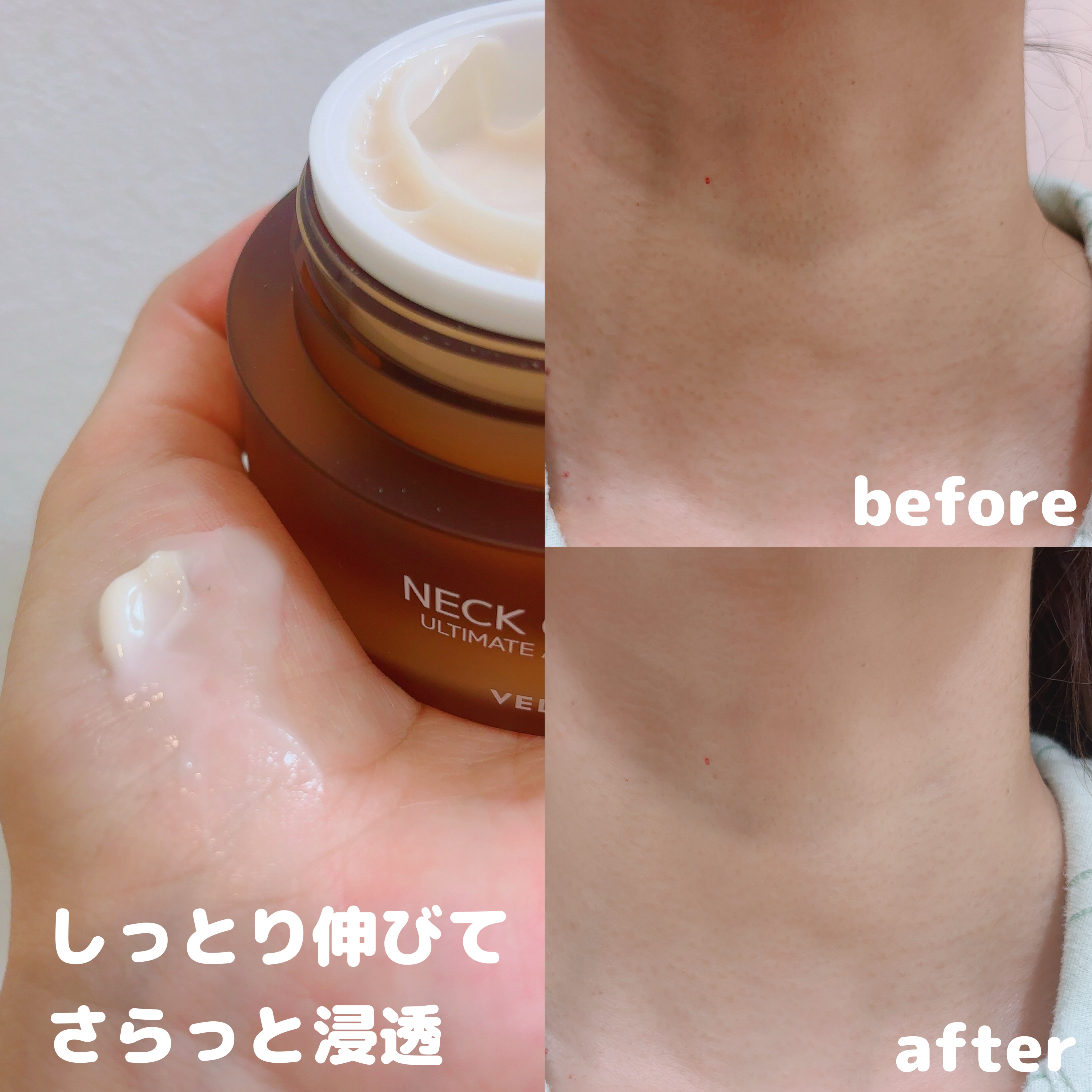 ベラ アルティメットエージ ネッククリーム/VELLA/フェイスクリームを使ったクチコミ（2枚目）