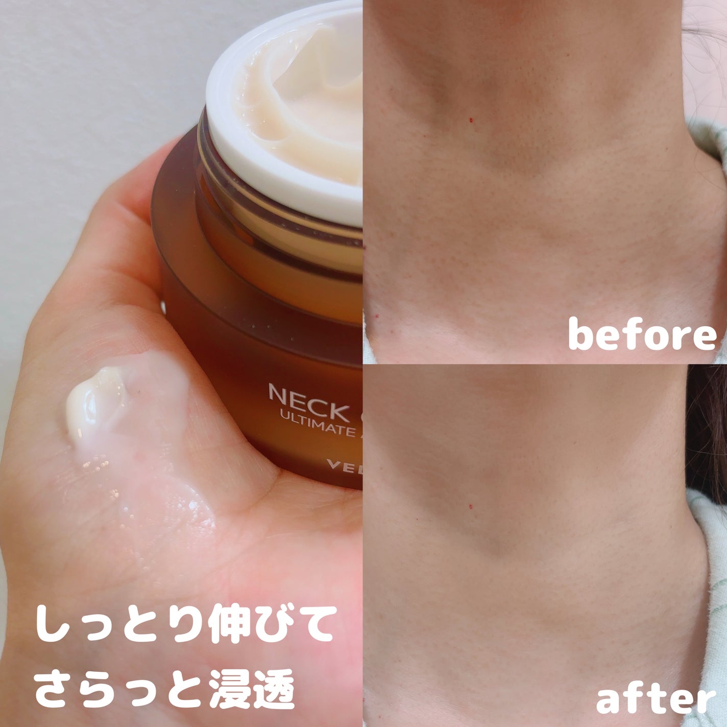 ベラ アルティメットエージ ネッククリーム/VELLA/フェイスクリームを使ったクチコミ(2枚目)
