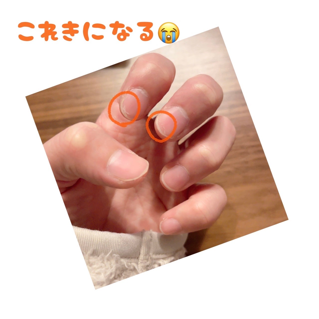 Mimits Moist Nail Serum ミミッツ モイストネイルセラム/ビー・エヌ/ネイルオイル・トリートメントを使ったクチコミ(2枚目)