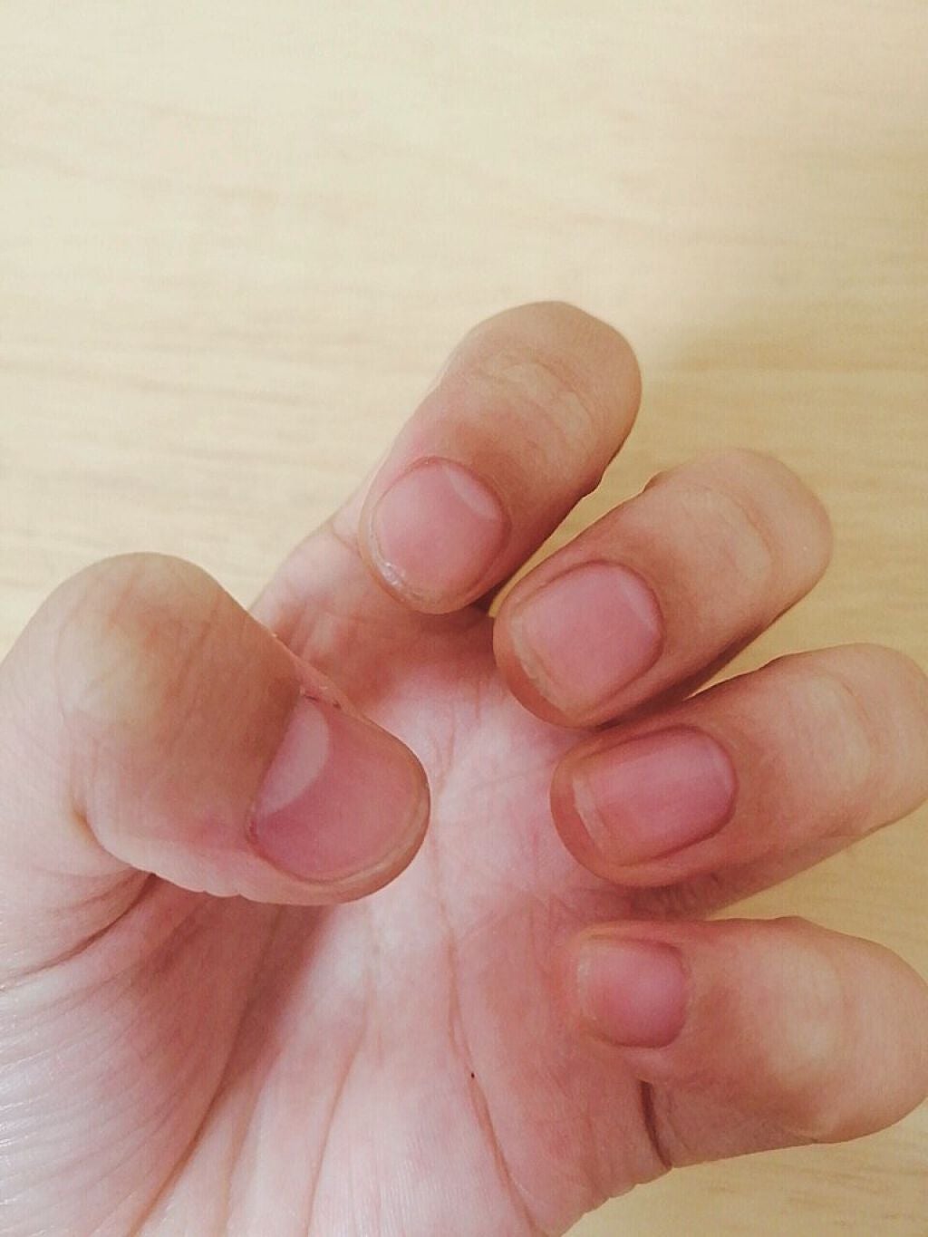 D.R on LIPS 「おはようございます٩(*´꒳`*)۶15日目の朝です!親指以外..」(2枚目)