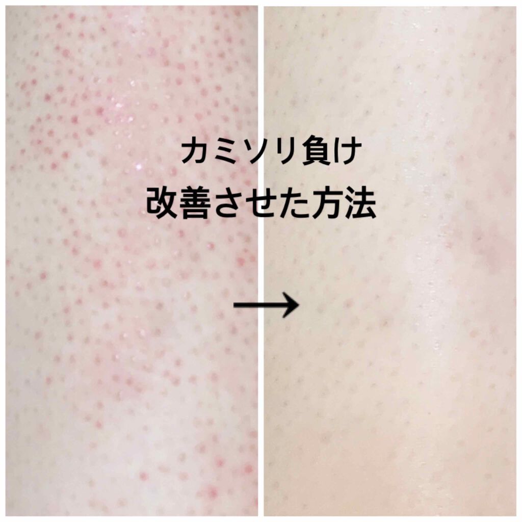 ノルウェー フォーミュラ インテンスリペア ボディ エマルジョン/Neutrogena/ボディローションを使ったクチコミ(1枚目)