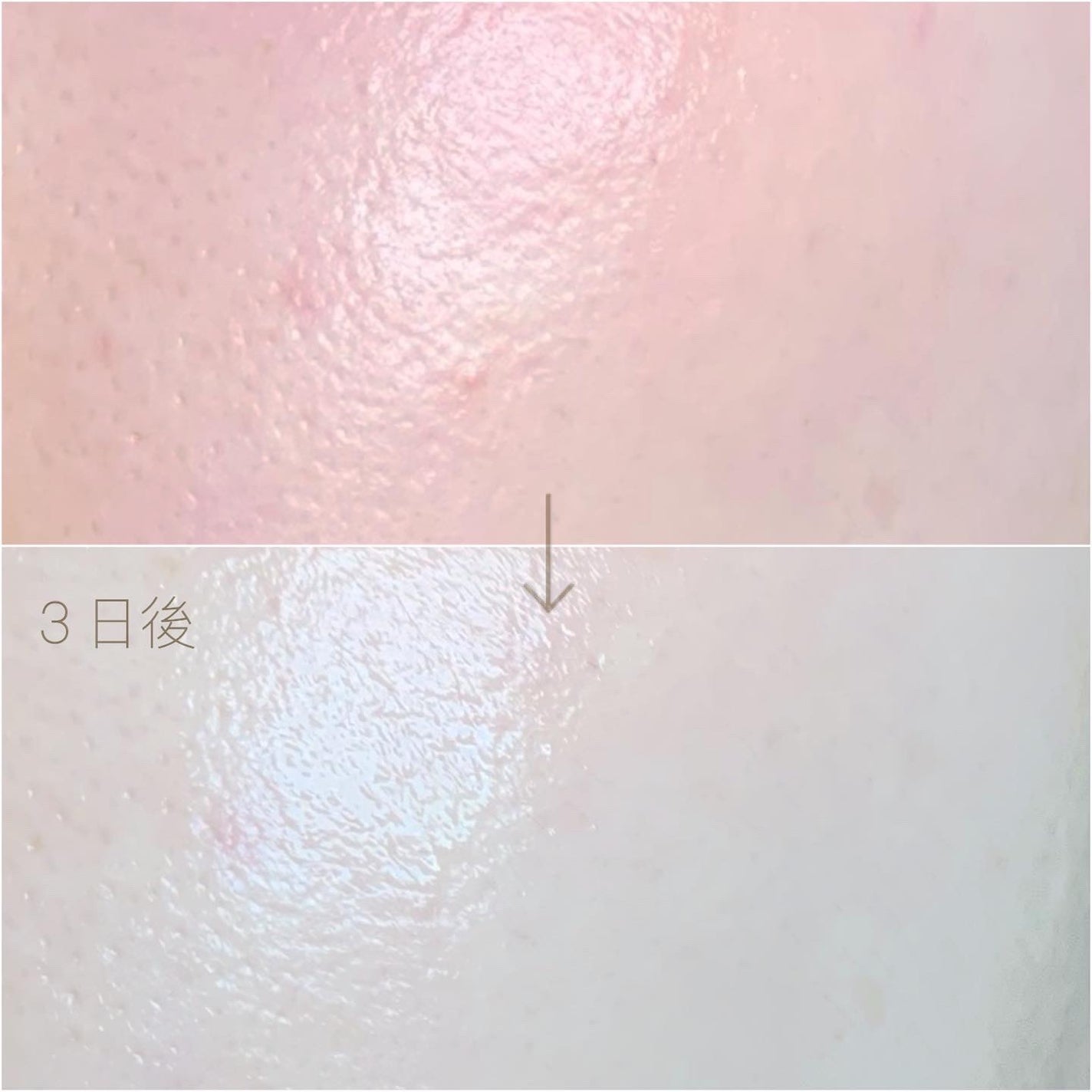 シカレチA エッセンス0.1/VT/美容液を使ったクチコミ(6枚目)