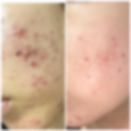 薬用ローション(とてもしっとり)/IHADA/化粧水を使ったクチコミ(1枚目)