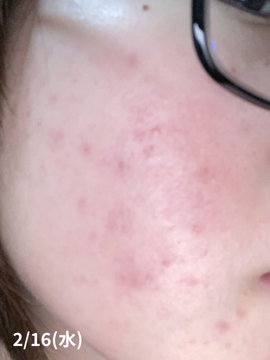 DHC 天然ビタミンE[大豆]/DHC/美容サプリメントを使ったクチコミ（2枚目）