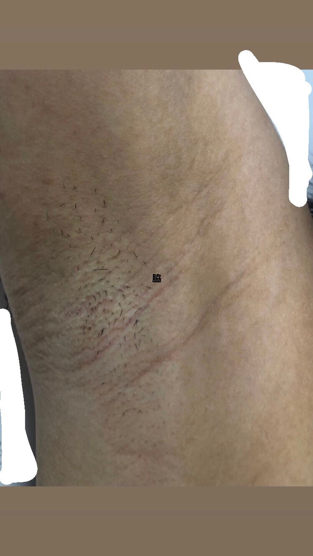 剛毛女 on LIPS 「⚠︎⚠︎⚠︎閲覧注意⚠︎⚠︎⚠︎すっごーーーーーく汚い写真です..」(7枚目)