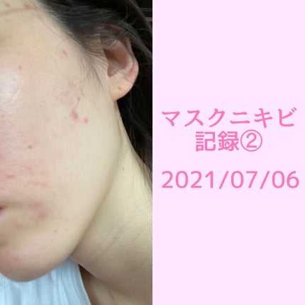 ハトムギ保湿ジェル(ナチュリエ スキンコンディショニングジェル)/ナチュリエ/美容液を使ったクチコミ(1枚目)