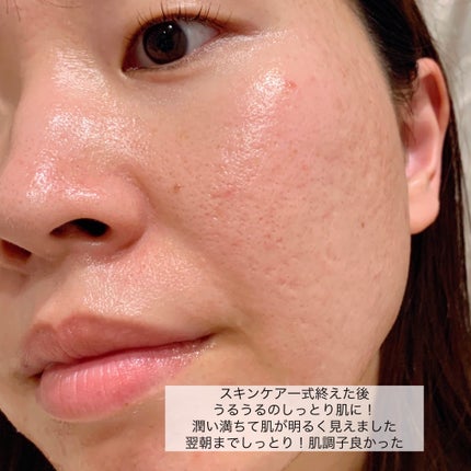 NL 塗って寝るパック/ナチュラルローソンスキンケア/フェイスクリームを使ったクチコミ(10枚目)