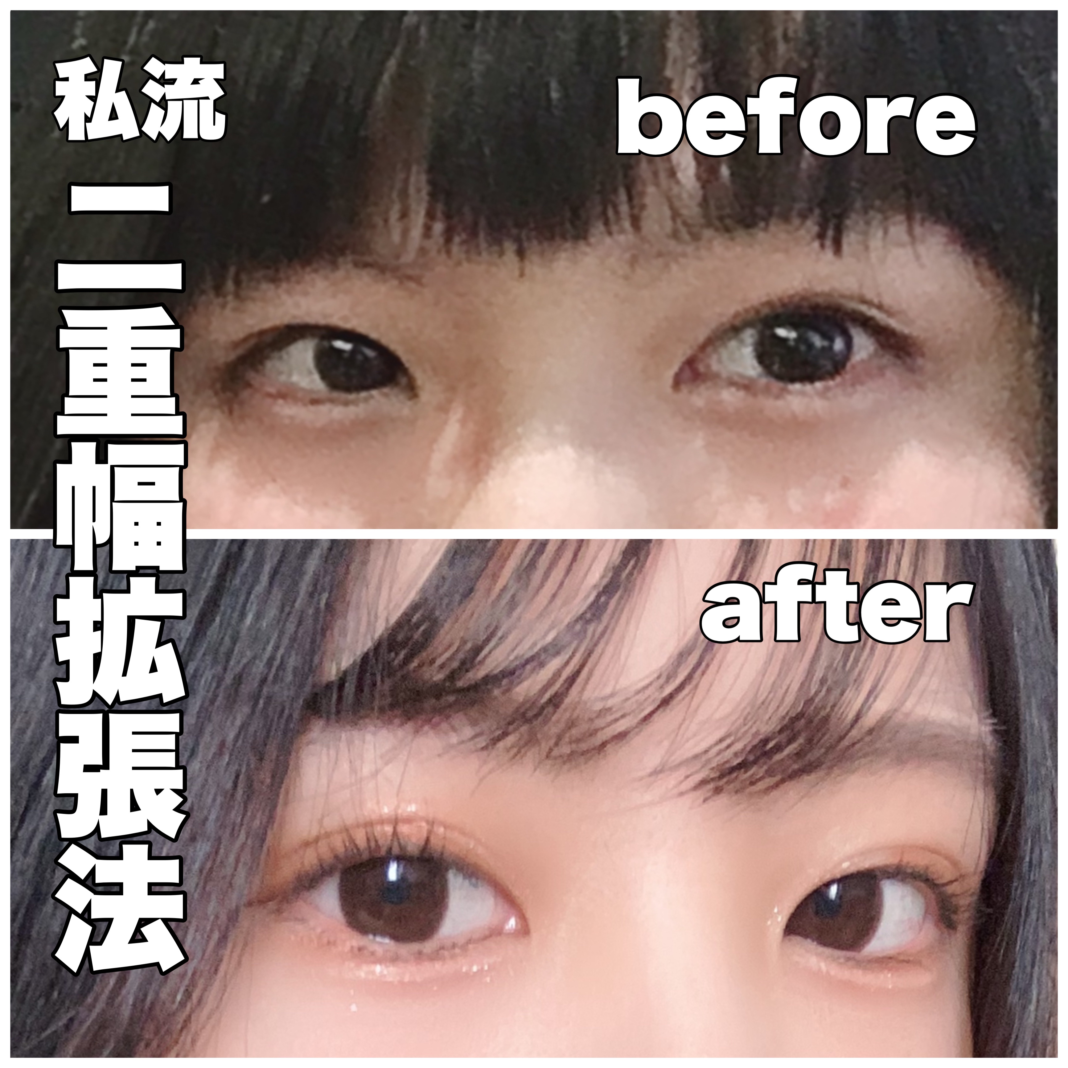 のびーるアイテープ（絆創膏タイプ、レギュラー）/DAISO/二重まぶた用アイテムを使ったクチコミ（1枚目）