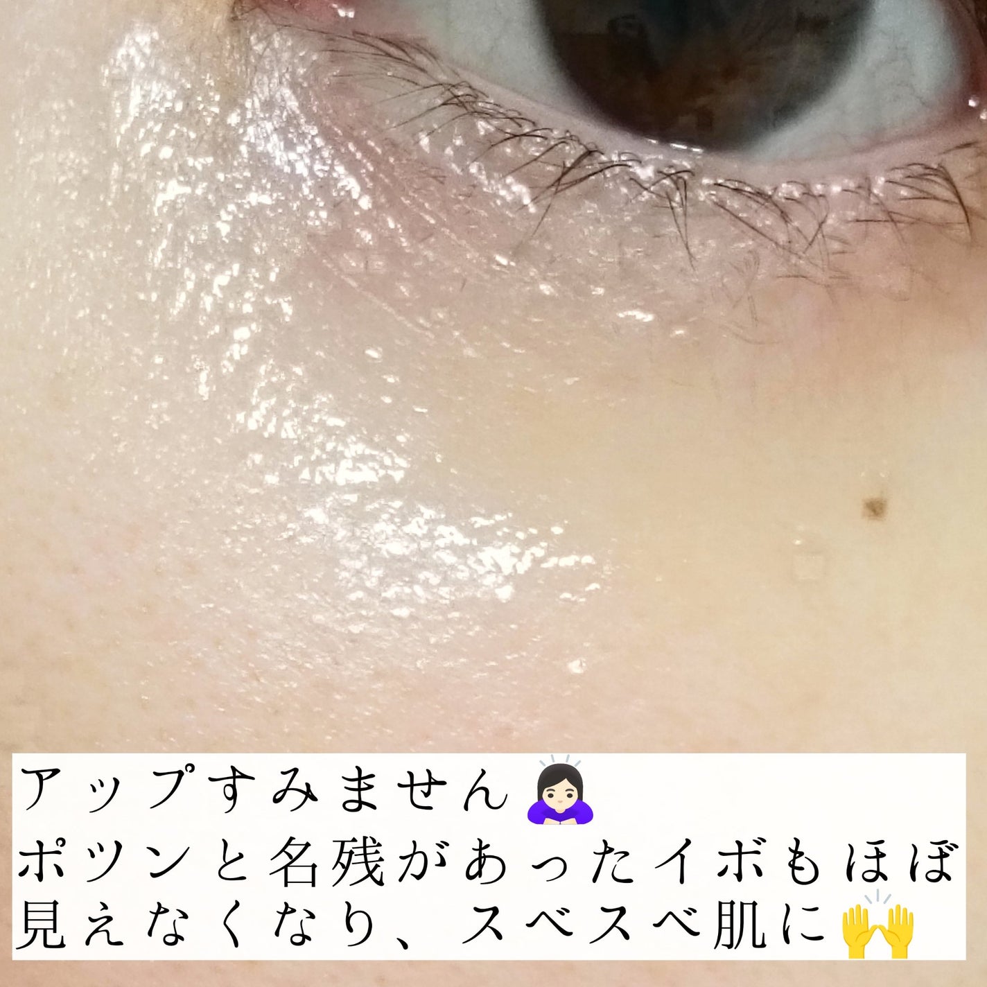 オーガニック ハトムギエキス (ヨクイニン)/KISO/その他を使ったクチコミ(4枚目)