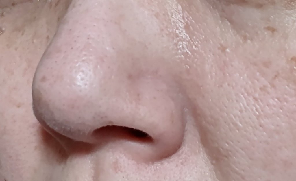 シカバイタル エッセンス/VT/美容液を使ったクチコミ（2枚目）