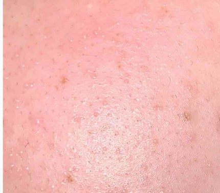 M クッション ファンデーション(プロカバー)/MISSHA/クッションファンデーションを使ったクチコミ(3枚目)