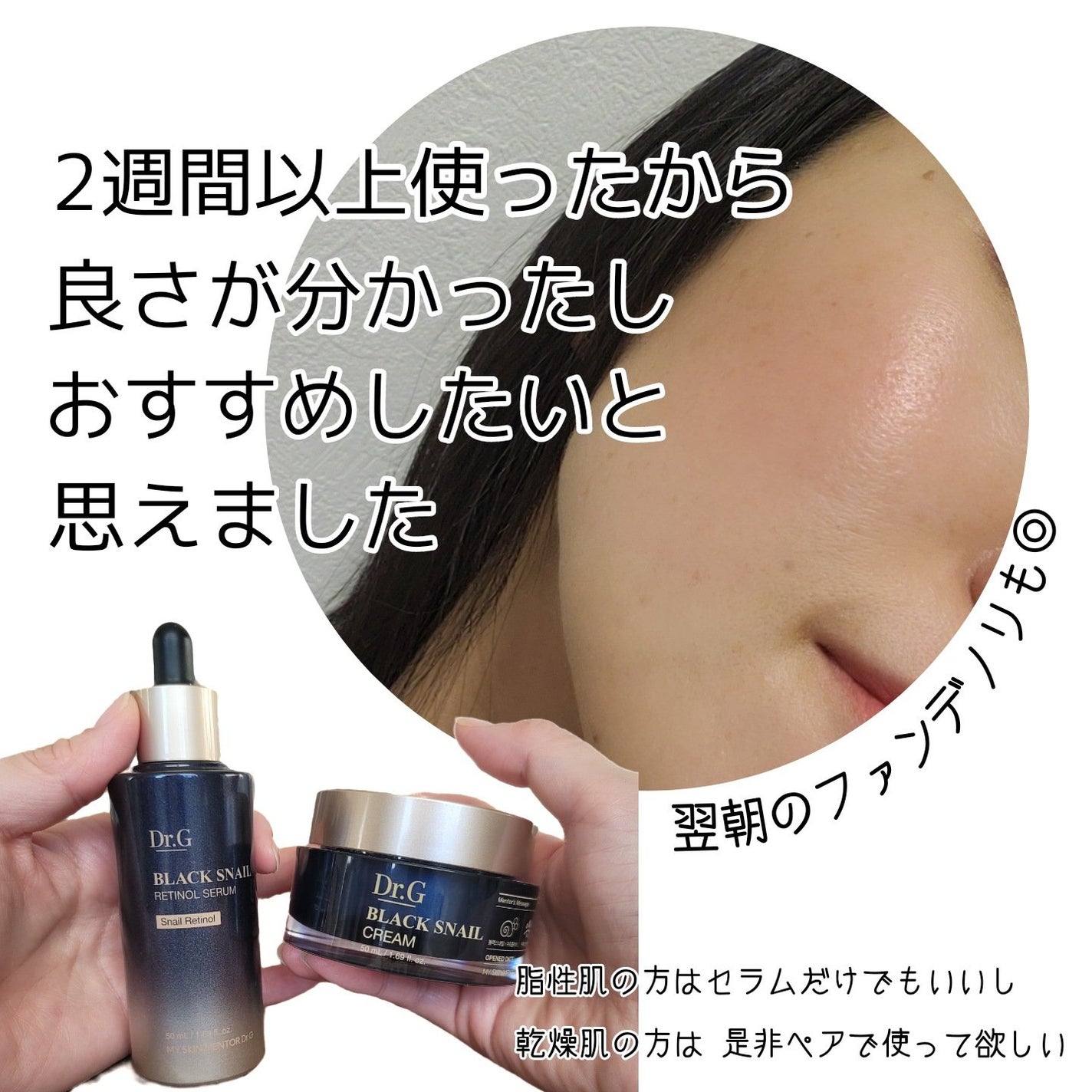 ブラックスネイル クリーム/Dr.G/フェイスクリームを使ったクチコミ(5枚目)