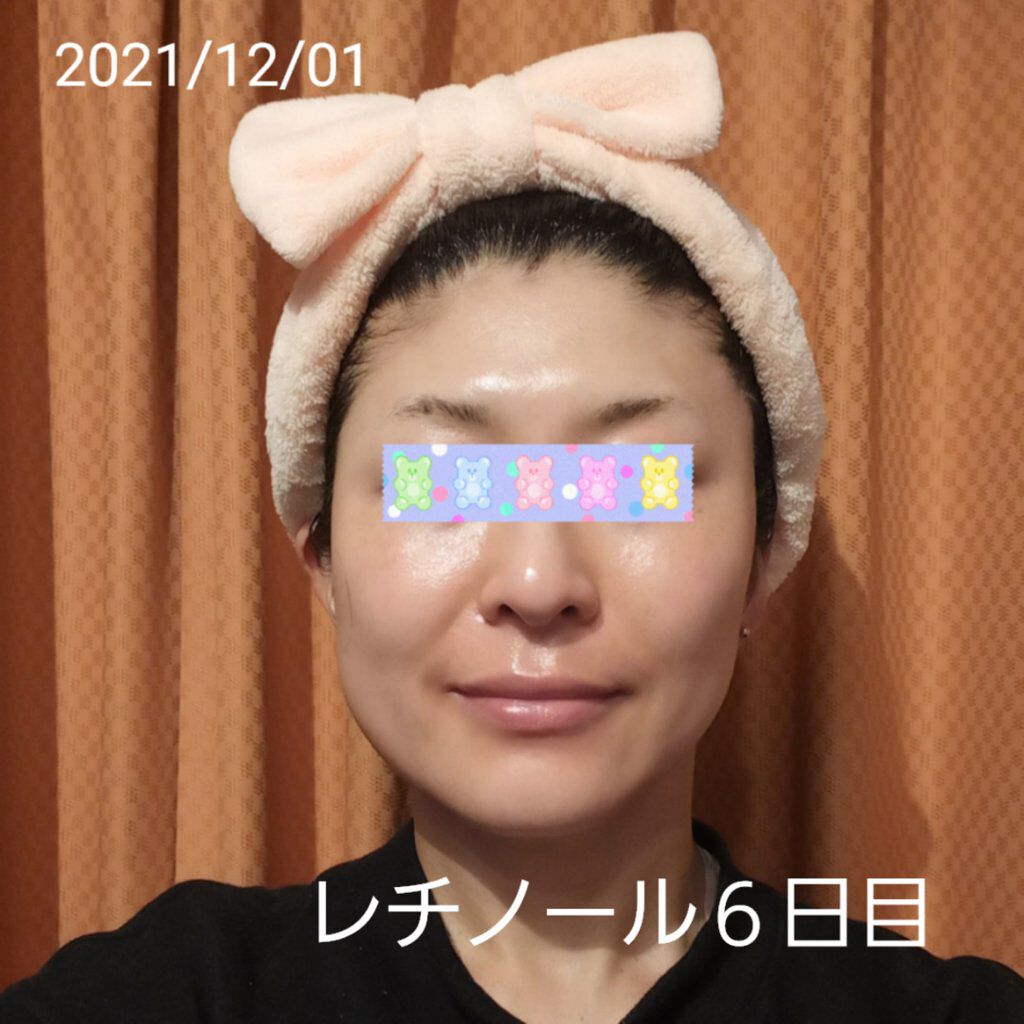 モイスチャーバーム ジャー/キュレル/フェイスクリームを使ったクチコミ（1枚目）