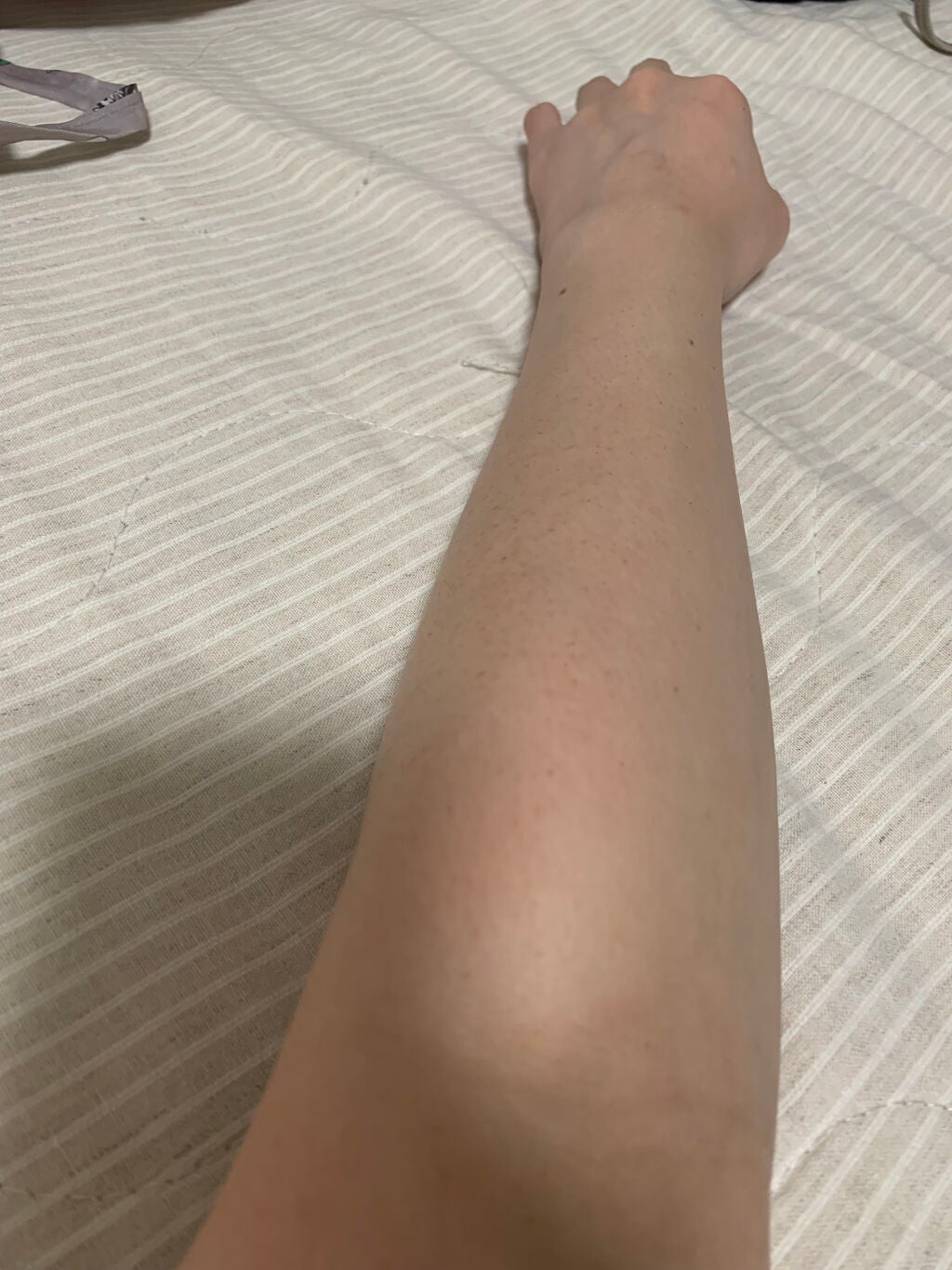 ケアノキュア(医薬品)/小林製薬/その他を使ったクチコミ(3枚目)