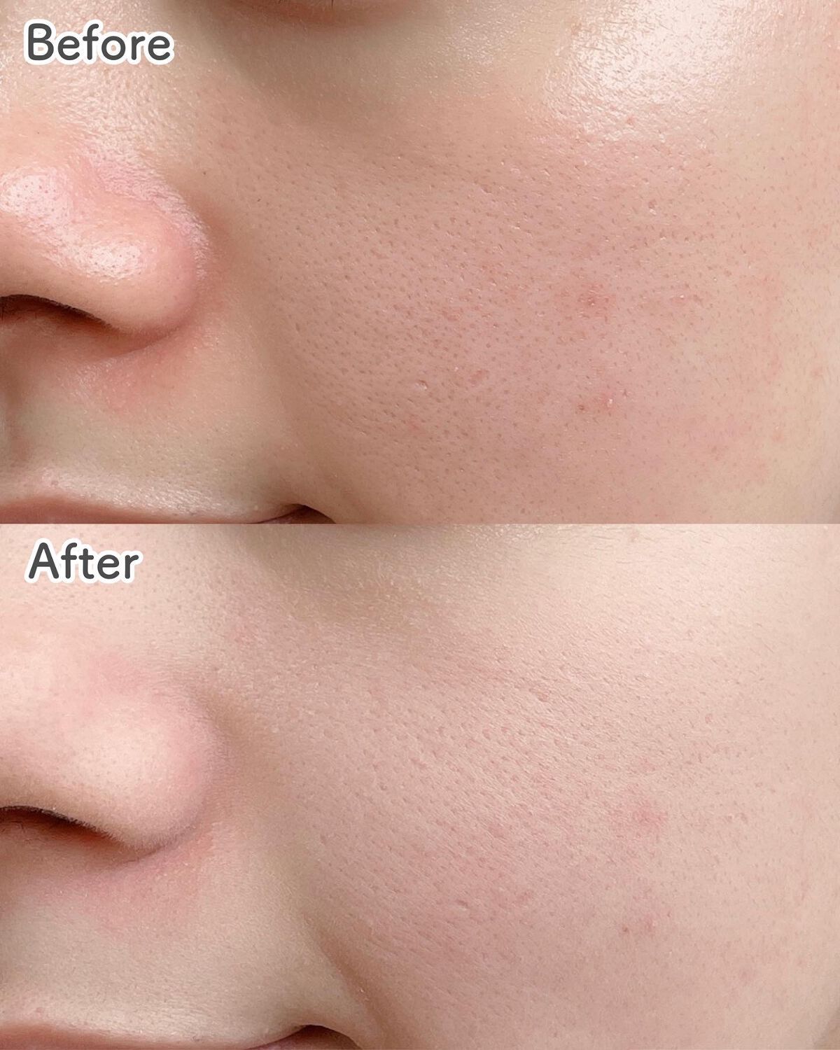 すっぴんホワイトニングパウダーA コンパクトタイプ/クラブ/フェイスパウダーを使ったクチコミ(2枚目)