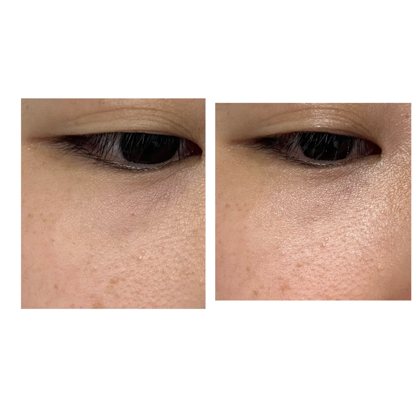 ごめんね素肌 クマらないアイクリーム/クリアターン/アイケア・アイクリームを使ったクチコミ(5枚目)