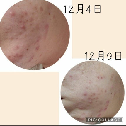 フェイスポリッシャー リフレッシング(ミント)/SABON/スクラブ・ゴマージュを使ったクチコミ(2枚目)