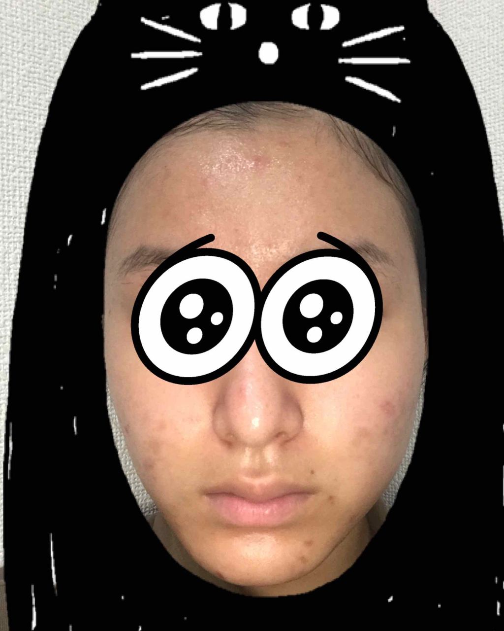 DHC ビタミンＣハードカプセル/DHC/美容サプリメントを使ったクチコミ（2枚目）