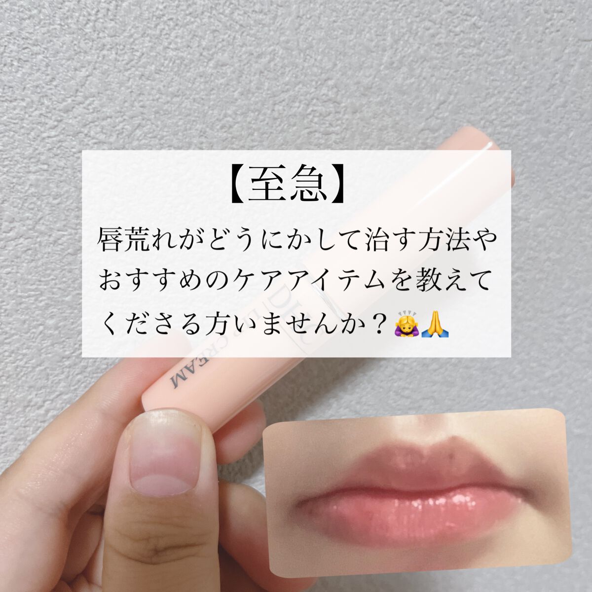 DHC 薬用リップクリーム/DHC/リップクリームを使ったクチコミ（1枚目）