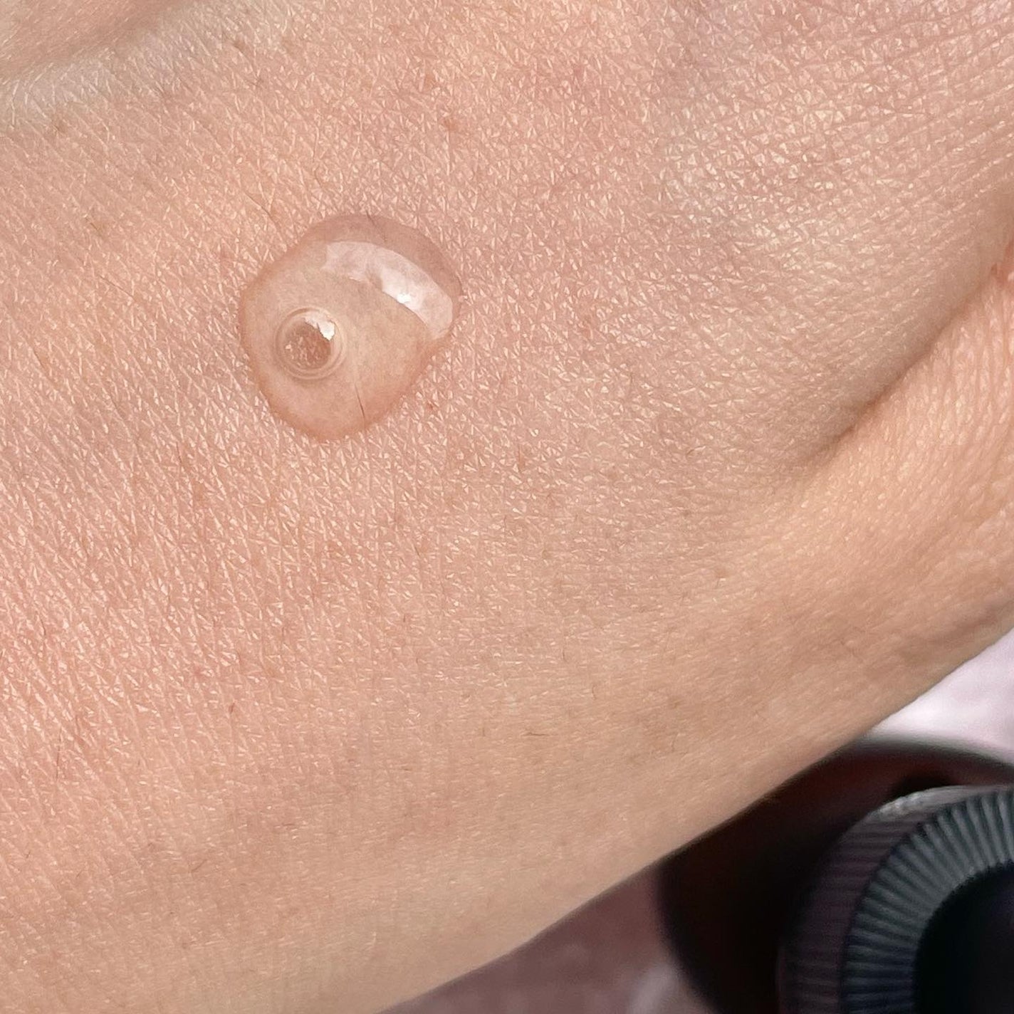 ヒト幹細胞培養エキス原液/fracora/美容液を使ったクチコミ(4枚目)