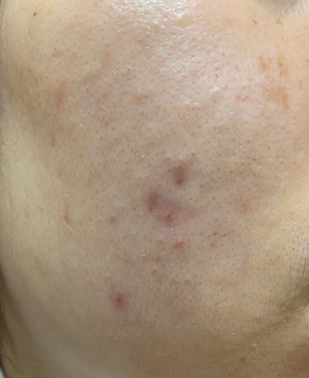 スキンケア洗顔料 スクラブin/ビオレ/洗顔フォームを使ったクチコミ（2枚目）