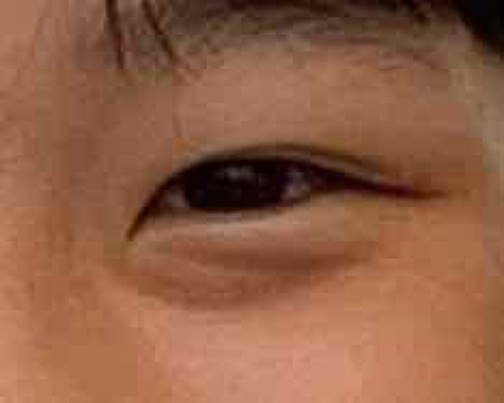 肌色タイプ/バンドエイド/その他を使ったクチコミ（2枚目）