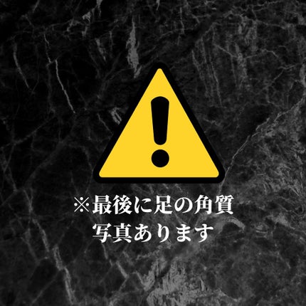 角質除去フットピーリング/One-day's you/ピーリングを使ったクチコミ(2枚目)