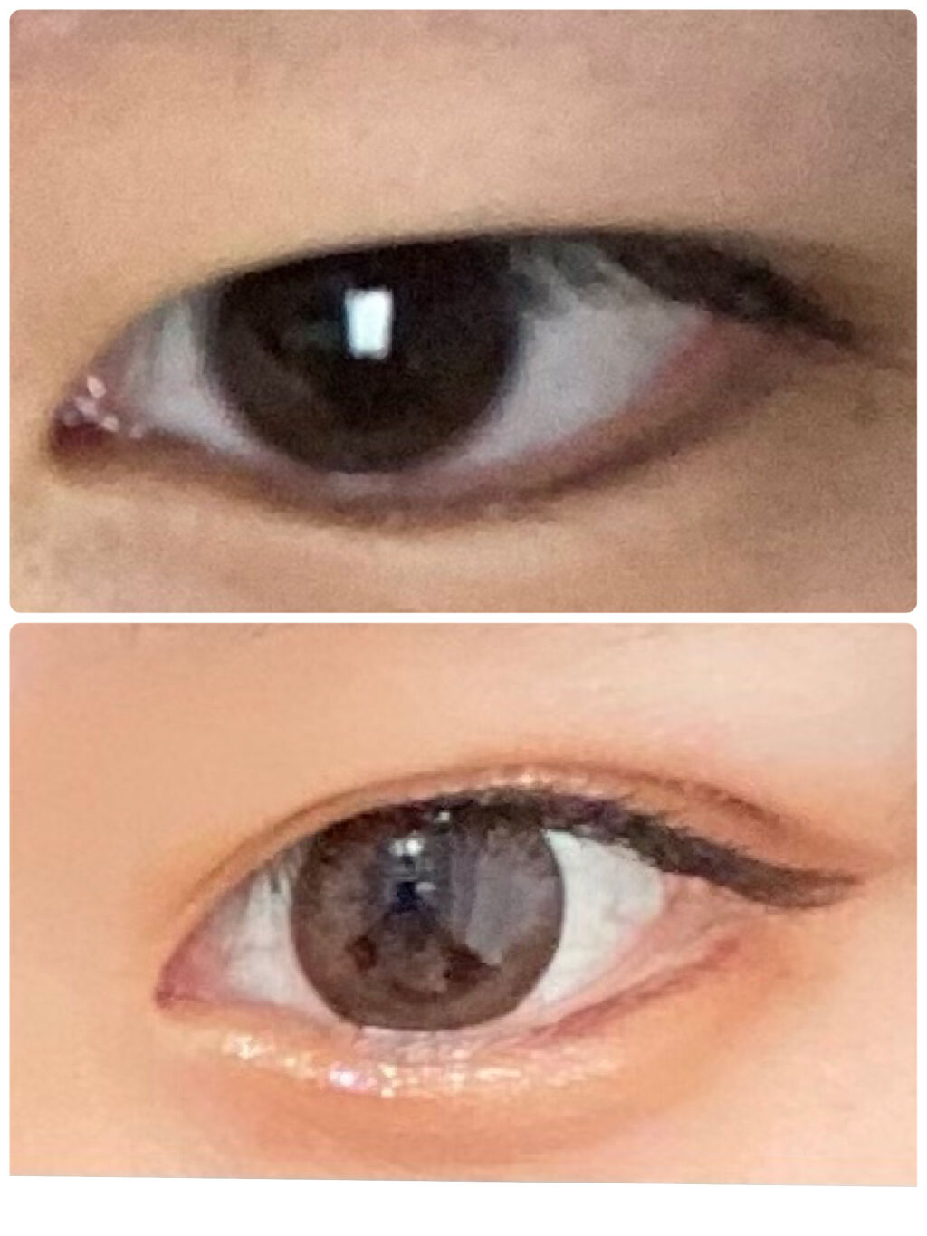 ふたえテープ 目立たず肌になじむ絆創膏タイプ/DAISO/二重まぶた用アイテムを使ったクチコミ（1枚目）