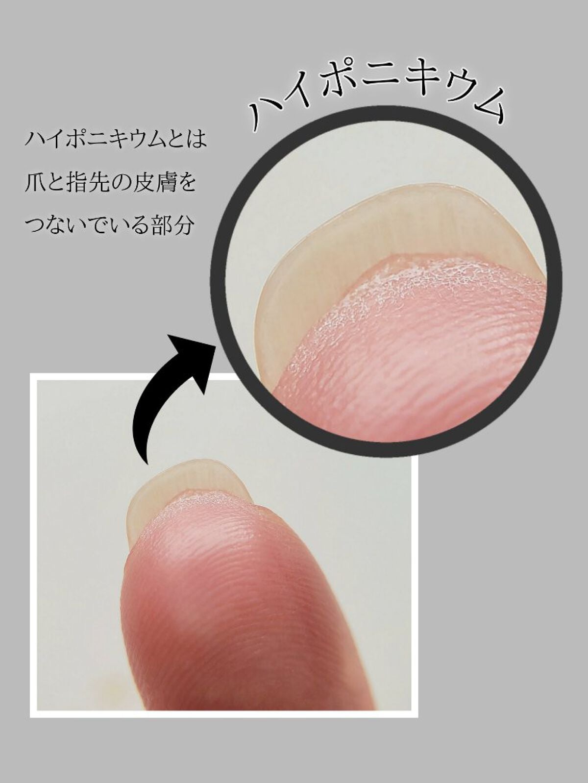 ネイルベッドオイル/アンドネイル/ネイルオイル・トリートメントを使ったクチコミ(3枚目)