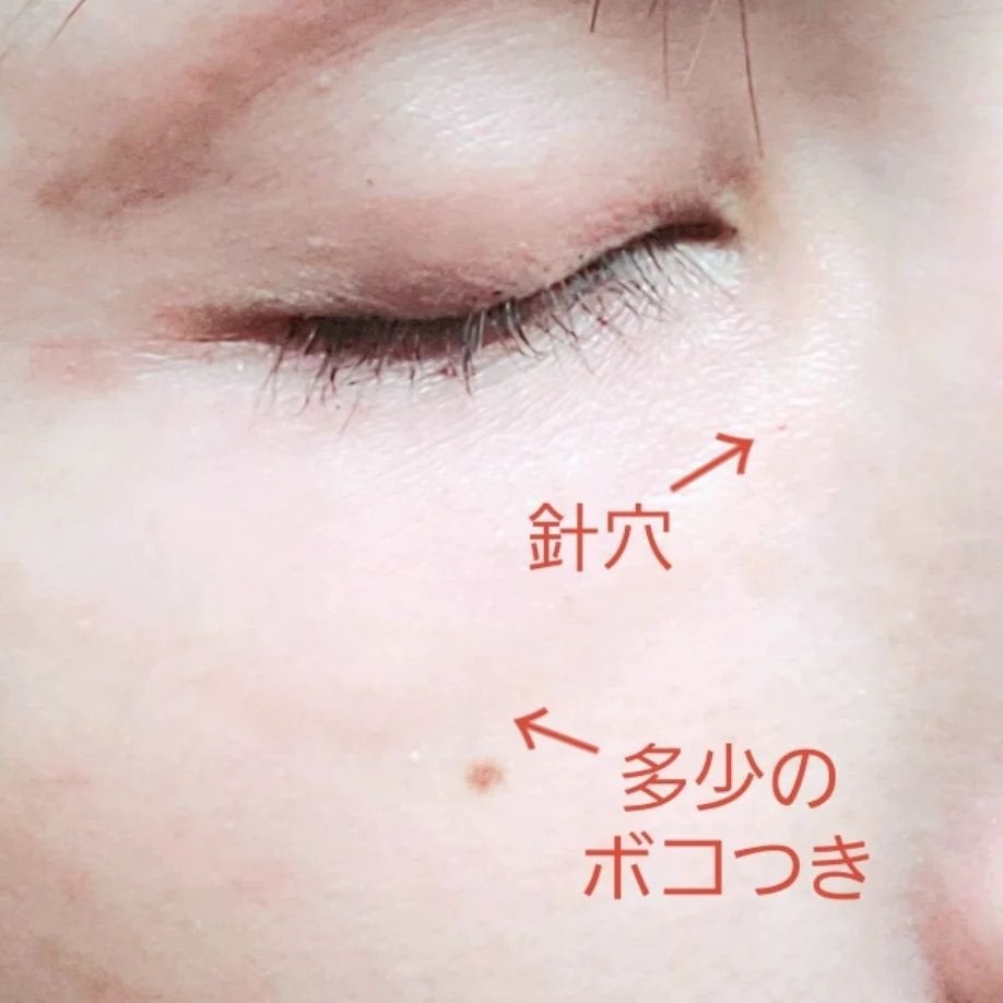 ちょこ on LIPS 「前回の投稿から2週間スネコス2回目行ってきました❗..」(2枚目)