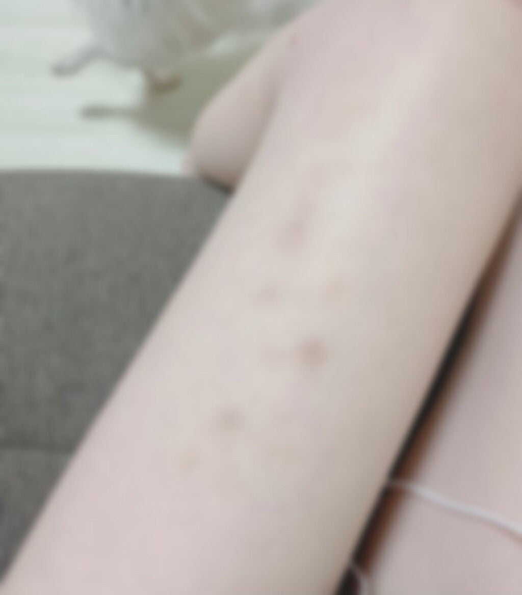 にゅん on LIPS 「さっしーがYouTubeでオススメしてた手持ちフォームローラー..」(3枚目)