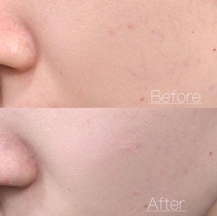 フィットミー フレッシュ ティント/MAYBELLINE NEW YORK/ベースメイクを使ったクチコミ(6枚目)