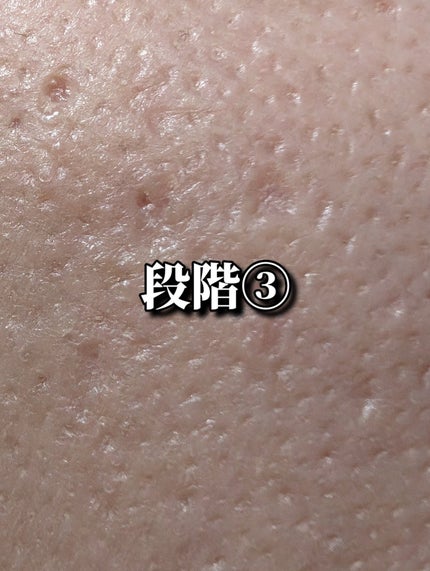 ドラマティックエッセンスヴェール ルースパウダー/マキアージュ/フェイスパウダーを使ったクチコミ(5枚目)