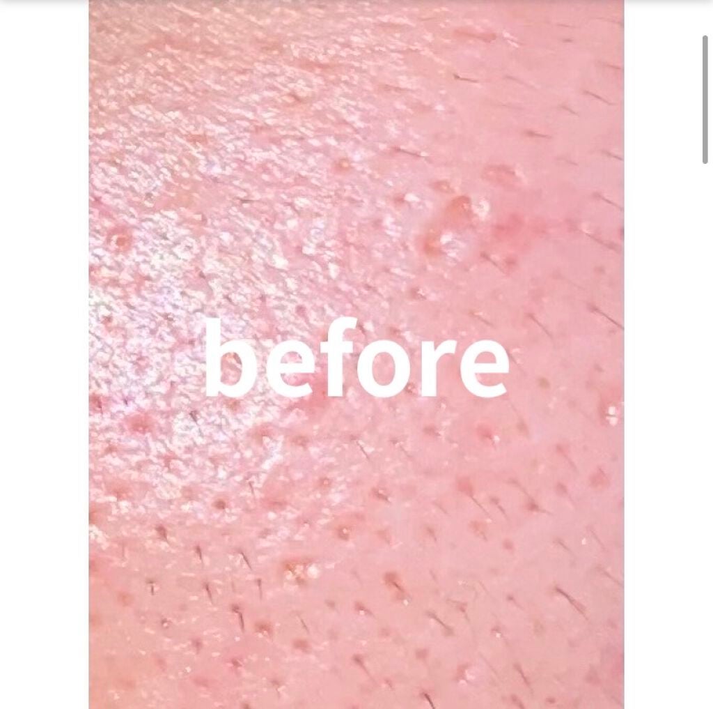 ベビーワセリン/健栄製薬/ボディクリームを使ったクチコミ(2枚目)