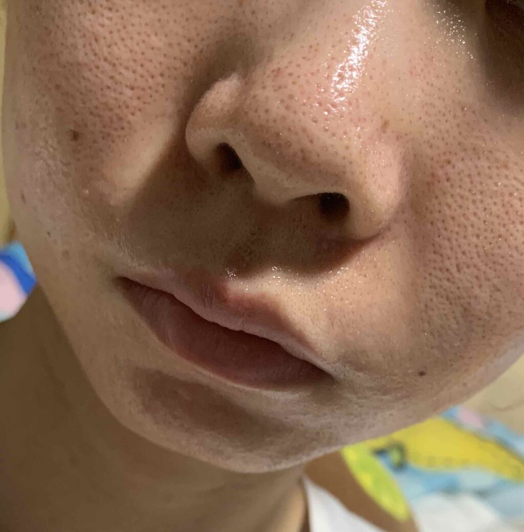 ハトムギ化粧水(ナチュリエ スキンコンディショナー R )/ナチュリエ/化粧水を使ったクチコミ(2枚目)