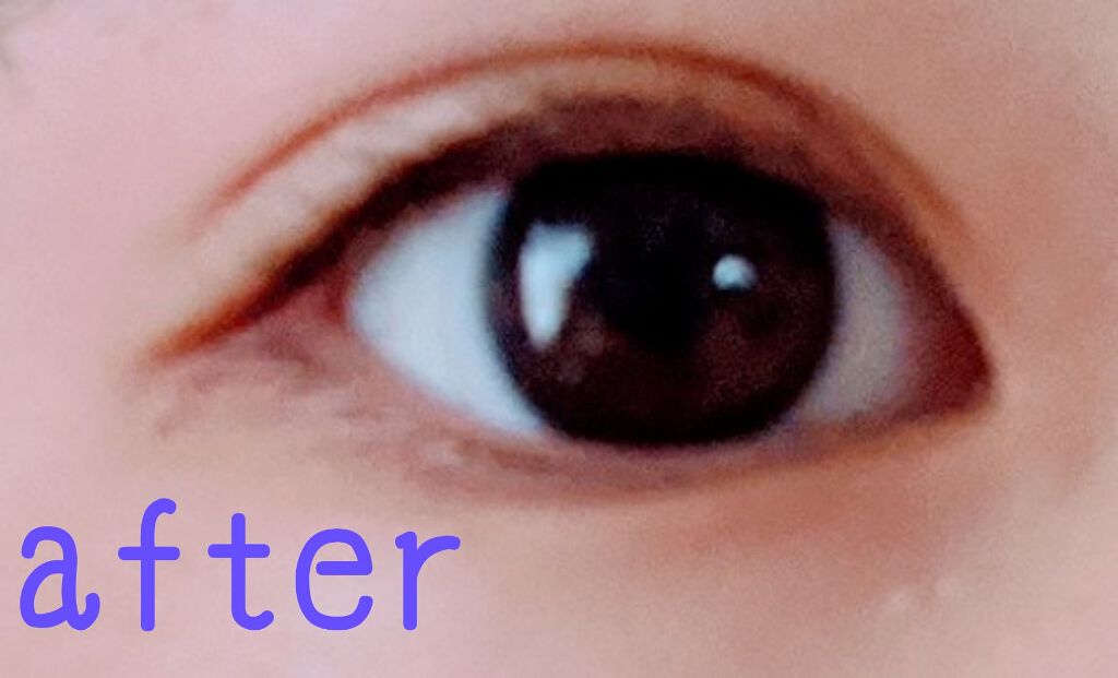 【旧品】オリシキ アイリッドスキンフィルム/D-UP/二重まぶた用アイテムを使ったクチコミ(3枚目)