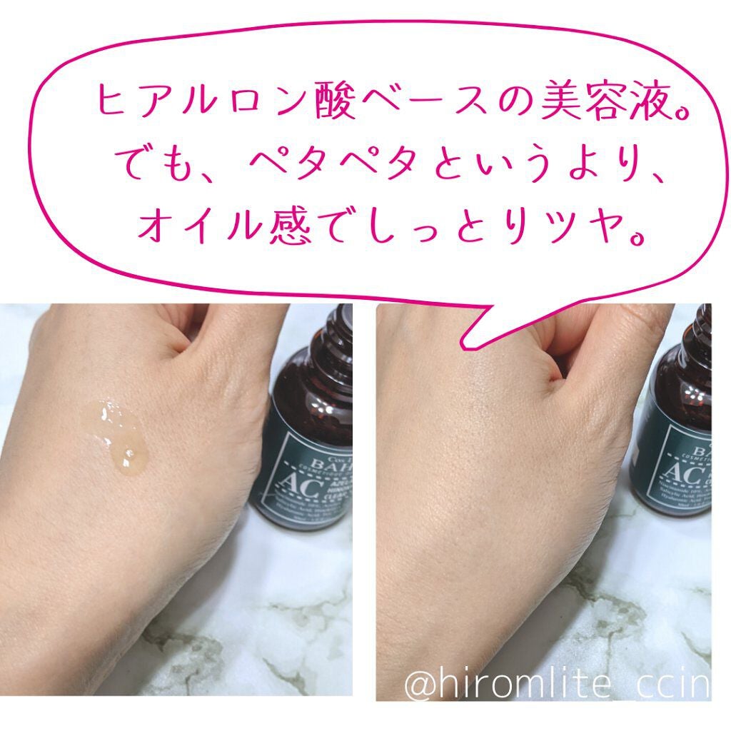 ACセラム/コスデバハ/美容液を使ったクチコミ(4枚目)