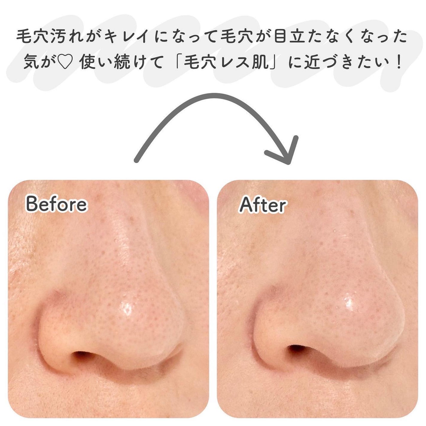 ダヴ 吸着毛穴ケア 洗顔ジェル/ダヴ/その他洗顔料を使ったクチコミ(4枚目)