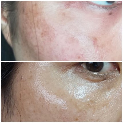 トーンショットクリーム/アバンタイム/フェイスクリームを使ったクチコミ(3枚目)