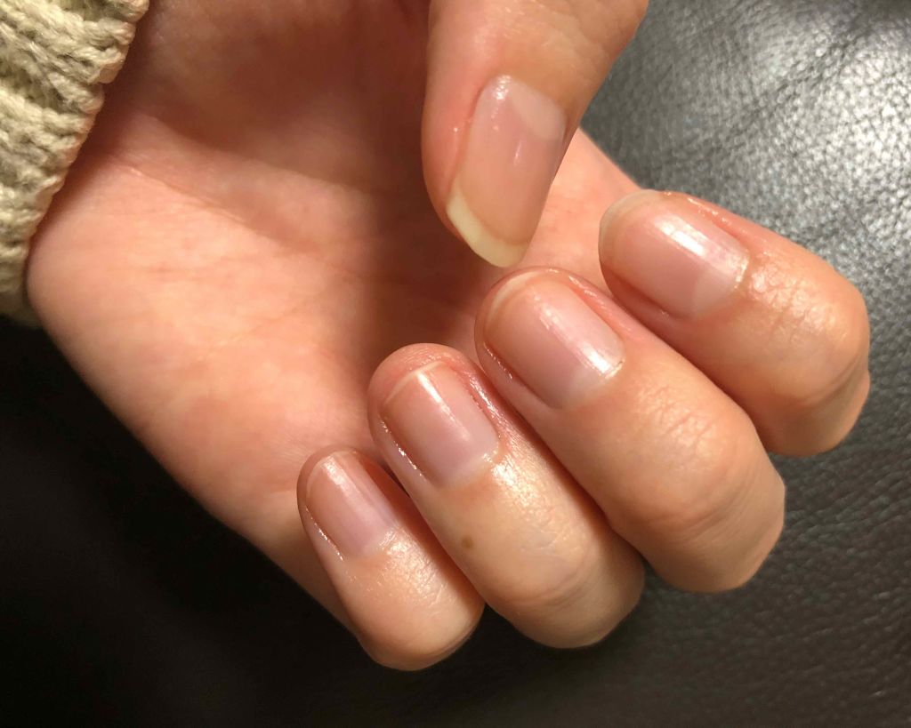 AC キューティクルオイル/AC MAKEUP/ネイルオイル・トリートメントを使ったクチコミ(3枚目)